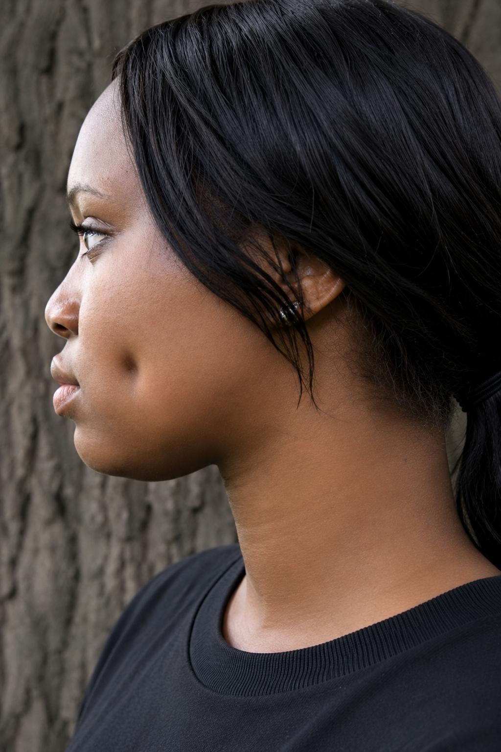 Fake dimples: A harmless trend or recipe for permanent facial damage ...